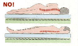 immagine della posizione della schiena su un materasso troppo rigido. Non corretta.
